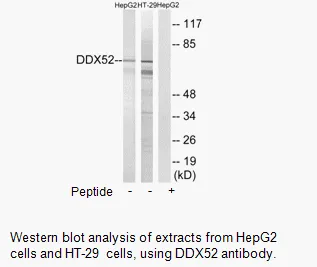 DDX52 Antibody - image 1