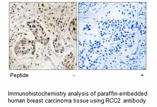 RCC2 Antibody - image 1