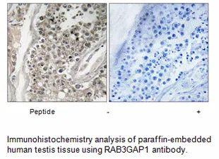 RAB3GAP1 Antibody - image 1