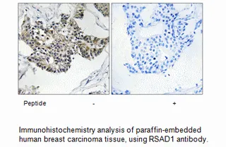 RSAD1 Antibody - image 1