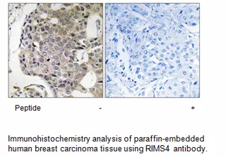 RIMS4 Antibody - image 1