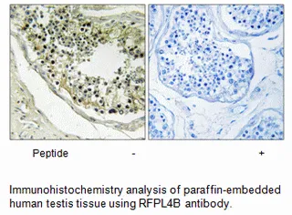RFPL4B Antibody - image 1