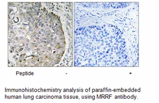 MRRF Antibody - image 2