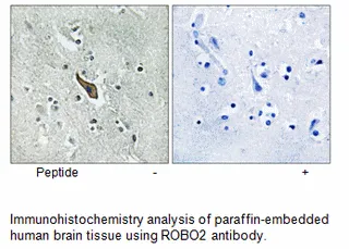 ROBO2 Antibody - image 1