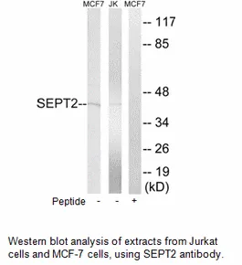 SEPT2 Antibody - image 1