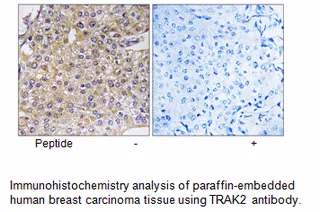 TRAK2 Antibody - image 1