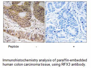RFX3 Antibody - image 1