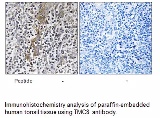 TMC8 Antibody - image 1