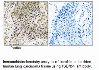 TSEN54 Antibody - image 1