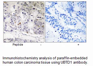 UBTD1 Antibody - image 1