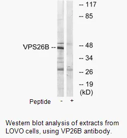 VPS26B Antibody - image 1