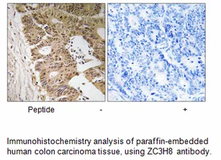ZC3H8 Antibody - image 1