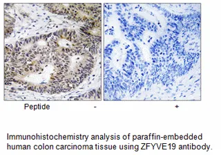 ZFYVE19 Antibody - image 2