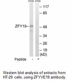 ZFYVE19 Antibody - image 1