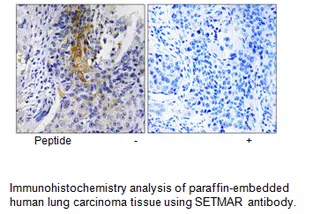 SETMAR Antibody - image 1