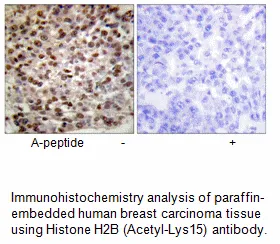 Histone H2B (Acetyl-Lys15) Antibody - image 2