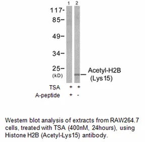 Histone H2B (Acetyl-Lys15) Antibody - image 3