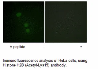 Histone H2B (Acetyl-Lys15) Antibody - image 1