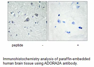 ADORA2A Antibody - image 2