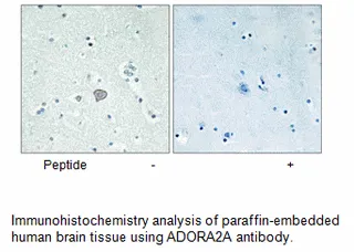 ADORA2A Antibody - image 4