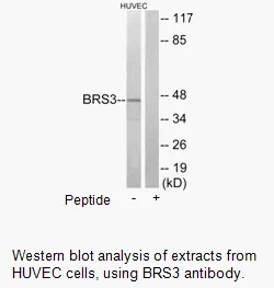 BRS3 Antibody - image 2