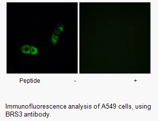 BRS3 Antibody - image 1