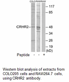 CRHR2 Antibody - image 2
