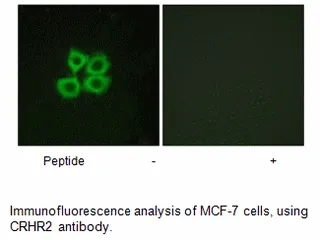 CRHR2 Antibody - image 1