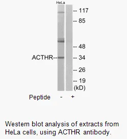 ACTHR Antibody - image 2