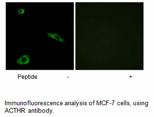 ACTHR Antibody - image 1