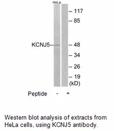 KCNJ5 Antibody - image 2