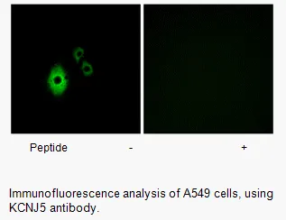 KCNJ5 Antibody - image 1