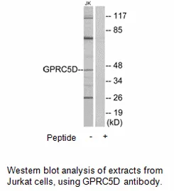 GPRC5D Antibody - image 2
