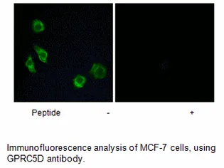 GPRC5D Antibody - image 1