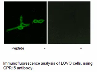 GPR15 Antibody - image 1
