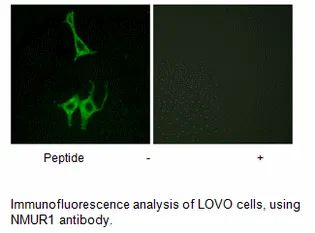 NMUR1 Antibody - image 1