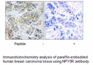 NPY5R Antibody - image 2