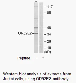 OR52E2 Antibody - image 1