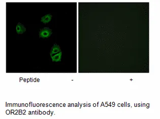 OR2B2 Antibody - image 2