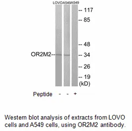OR2M2 Antibody - image 2