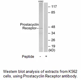 Prostacyclin Receptor Antibody - image 2