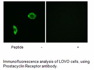 Prostacyclin Receptor Antibody - image 1