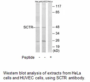 SCTR Antibody - image 1