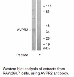 AVPR2 Antibody - image 1