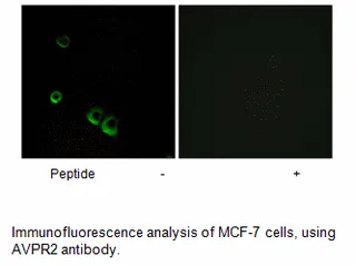 AVPR2 Antibody - image 2