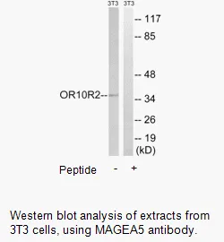 MAGEA5 Antibody - image 1
