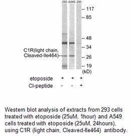 C1R (light chain,Cleaved-Ile464) Antibody - image 1