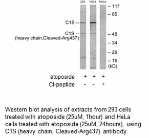 C1S (heavy chain,Cleaved-Arg437) Antibody - image 1