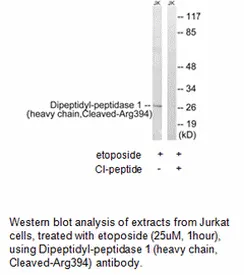 Dipeptidyl-peptidase 1 (heavy chain,Cleaved-Arg394) Antibody - image 1