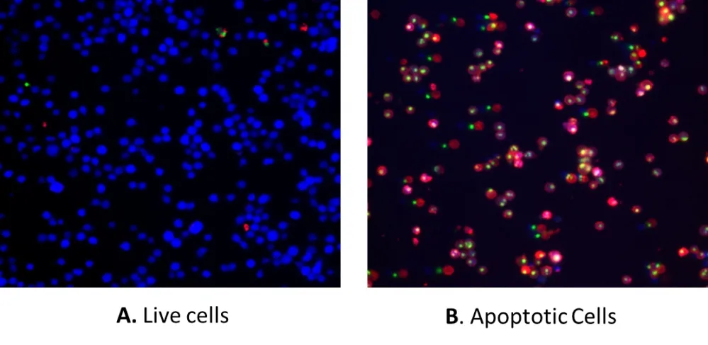 Cell Meter™ Apoptotic and Necrotic Multiplexing Detection Kit II *Triple Fluorescence Colors* - image 1